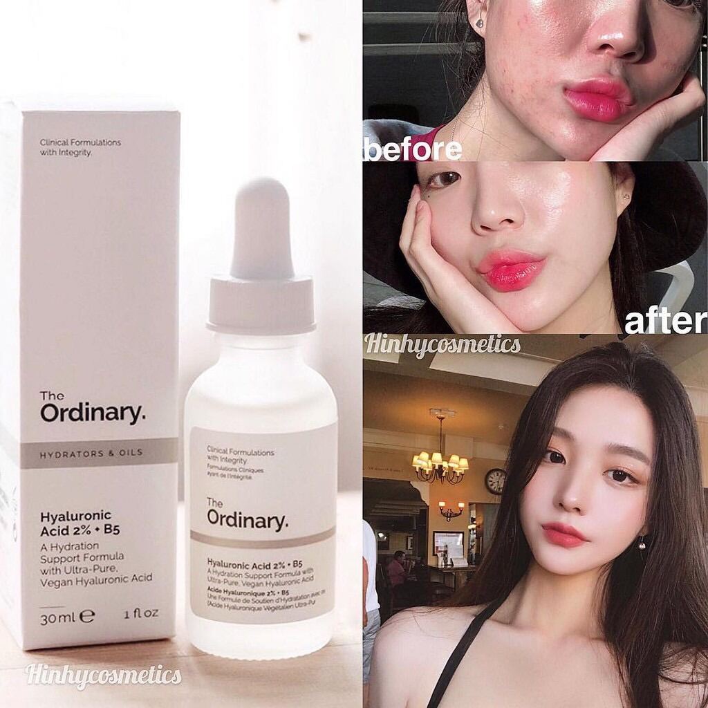 Tinh chất The Ordinary Hyaluronic Acid 2% + B5