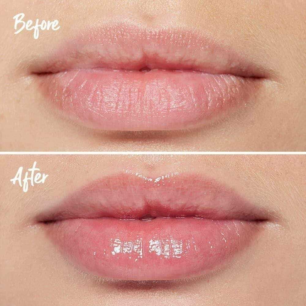 [Hàng Cty] Son Dưỡng Làm Căng Đầy Môi TEOXANE 3D LIP 10ML