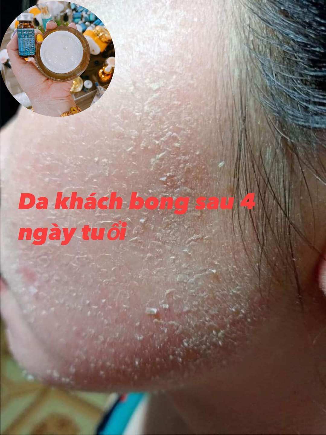 kem face bong da