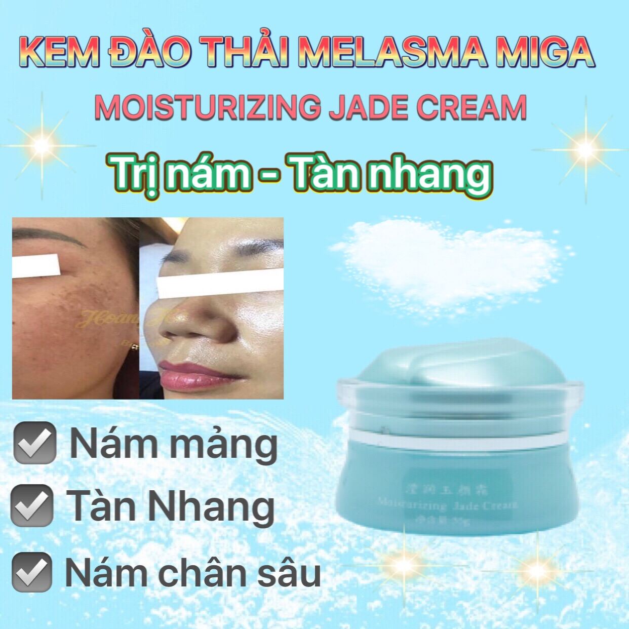 Kem Nám Tàn Nhang Và Dưỡng Trắng Da Miga - Miga Moisturizing Jade Cream 35G