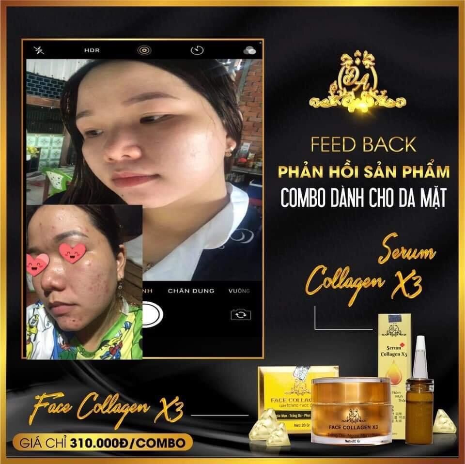 Kem face colagen x3