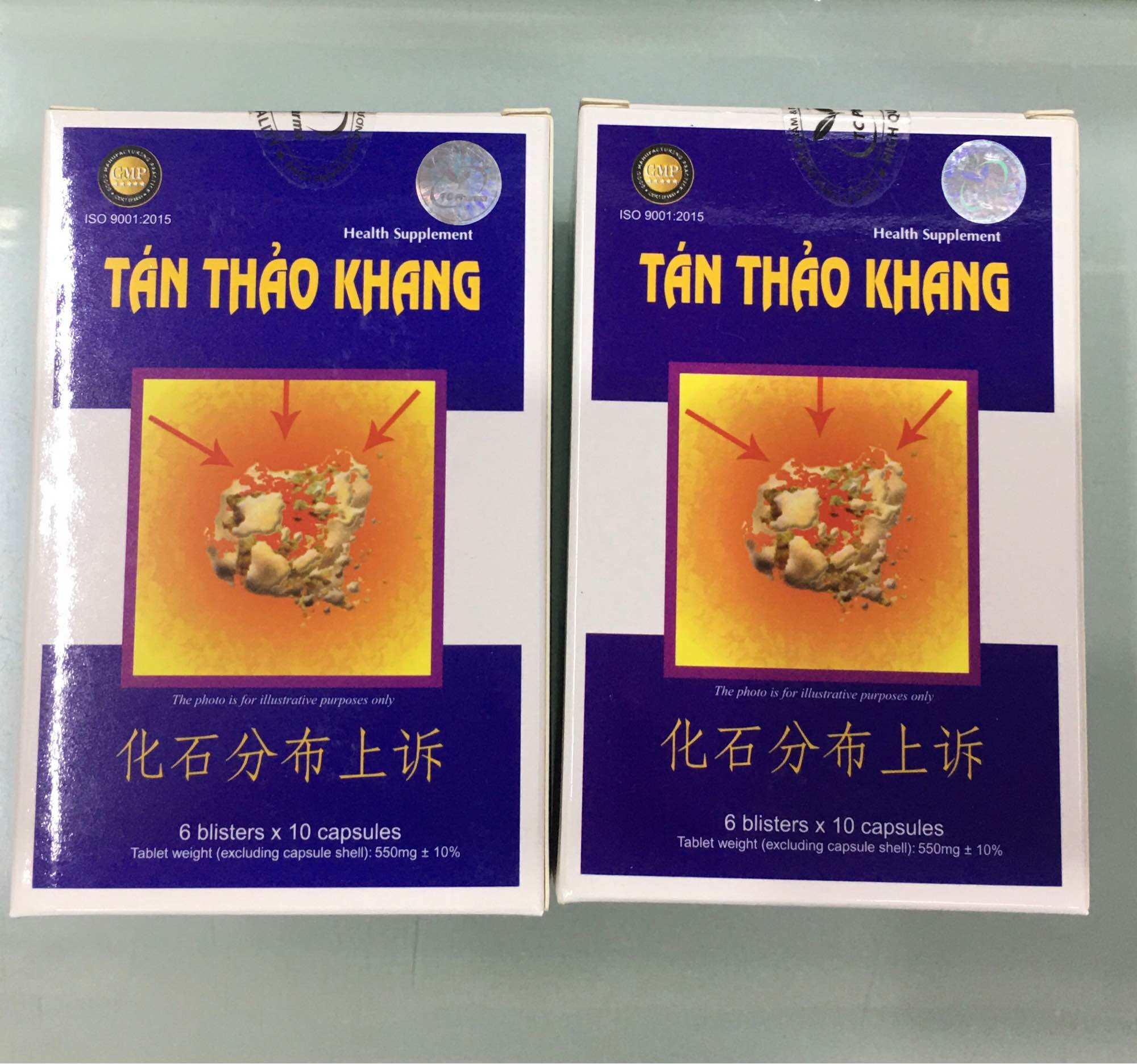 Tán thảo khang đánh bay sỏi thận, sỏi niệu quản, sỏi bàng quang