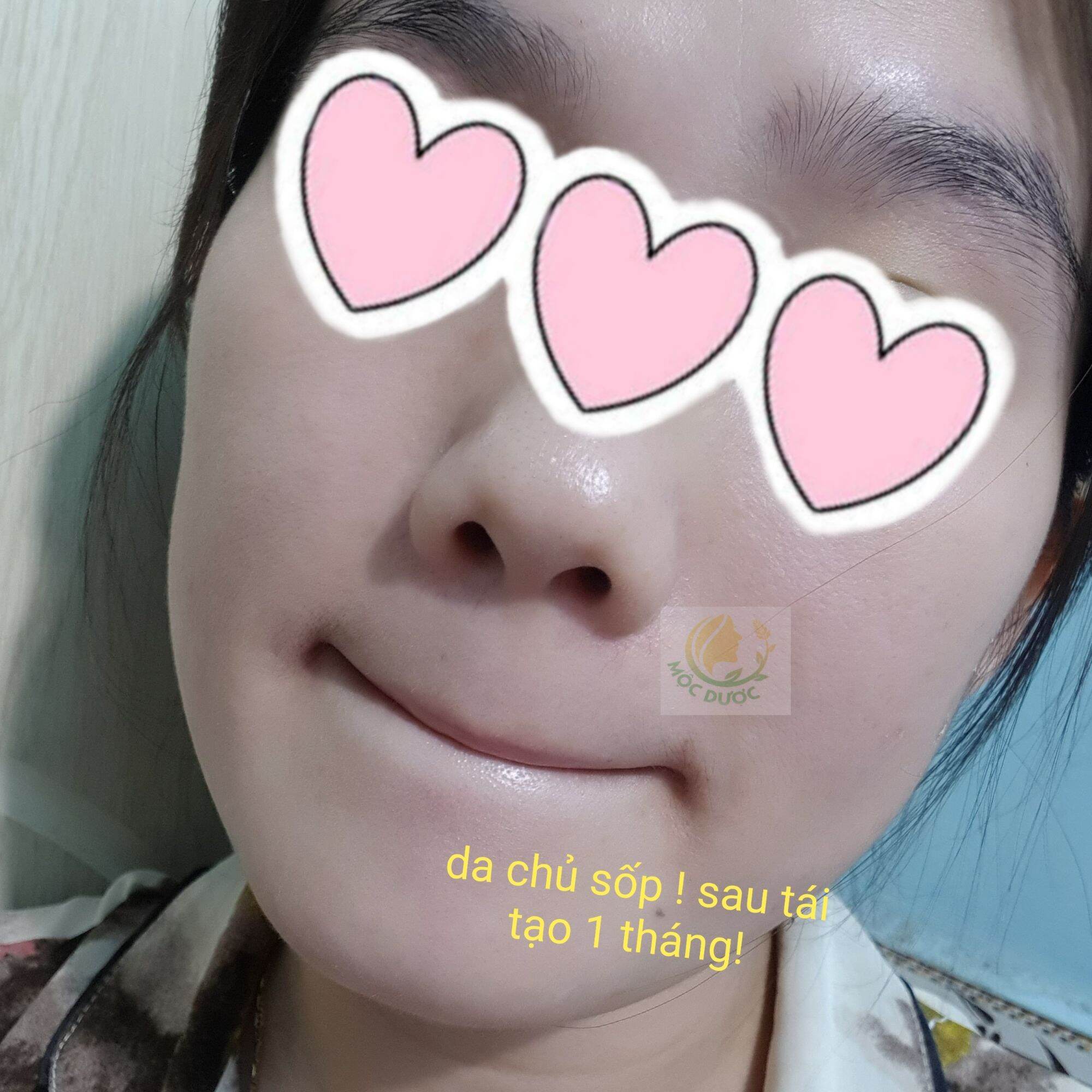 Combo tái tạo da Mộc Dược