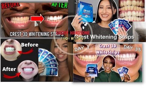 Miếng dán trắng răng crest 3d white professional effects siêu trắng - ảnh sản phẩm 2