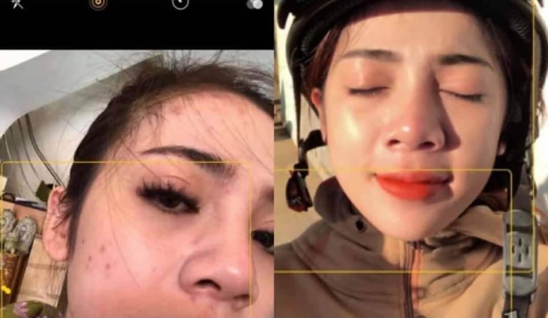 Kem Mụn, Tàn Nhang, Mờ Thâm Demejine ( mẫu hộp tròn )