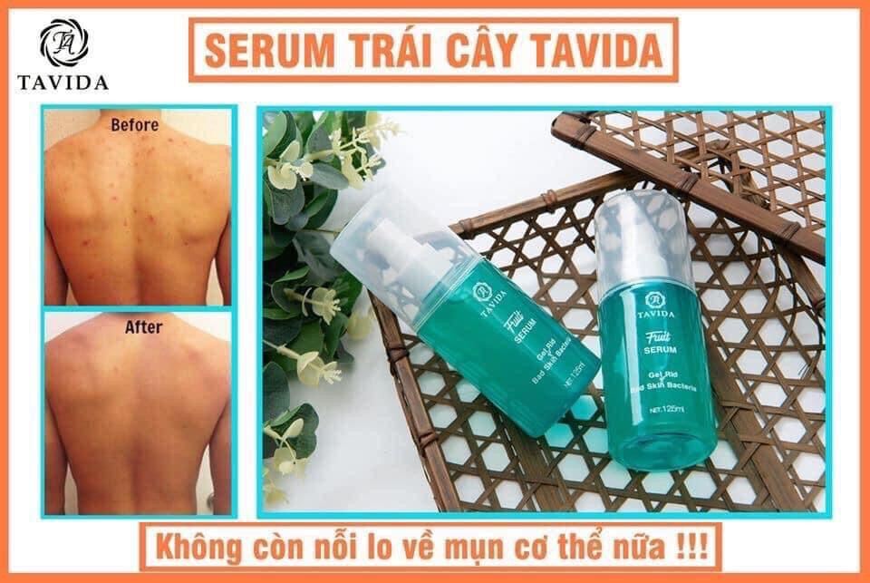 Combo 2 Chai Serum Trái Cây Lên Men Tavida * Xịt Mụn Lưng Men Vi Sinh Tavida* Dứt Điểm Các Vấn Đề Về Da Như Viêm Nang Lông Mụn Lưng Nấm Ngứa