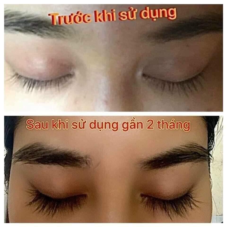 Dưỡng mi max chính hãng dài gấp 5 lần