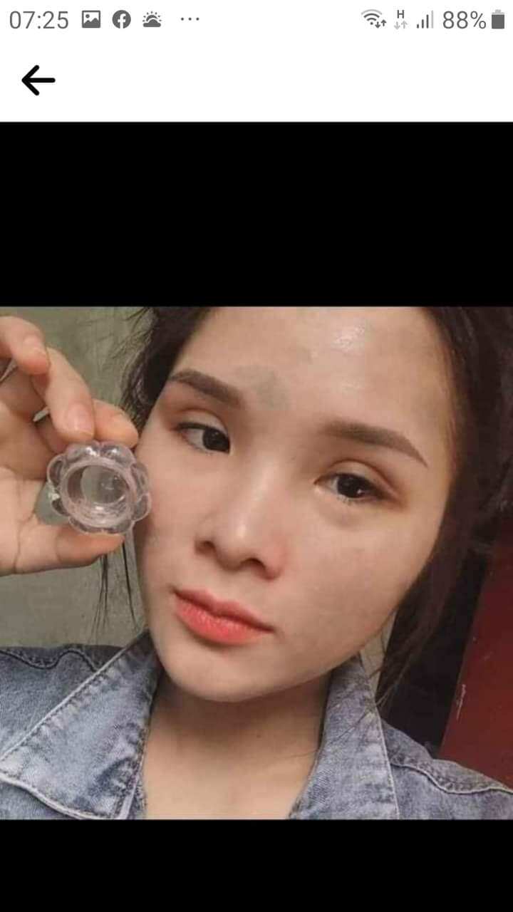 (Chính Hãng) Kem mụn thảo dược hoa đào giá sỉ