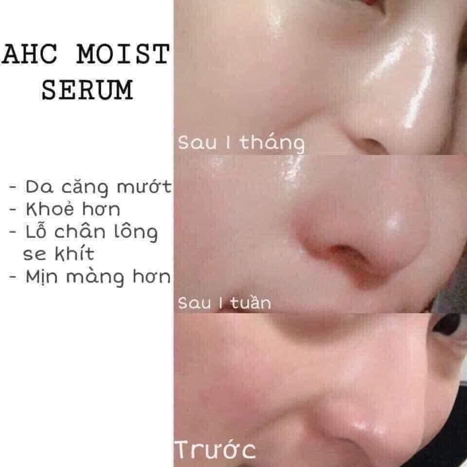 Xịt Khoáng AHC Royal Truffle Mist Serum 100ml
