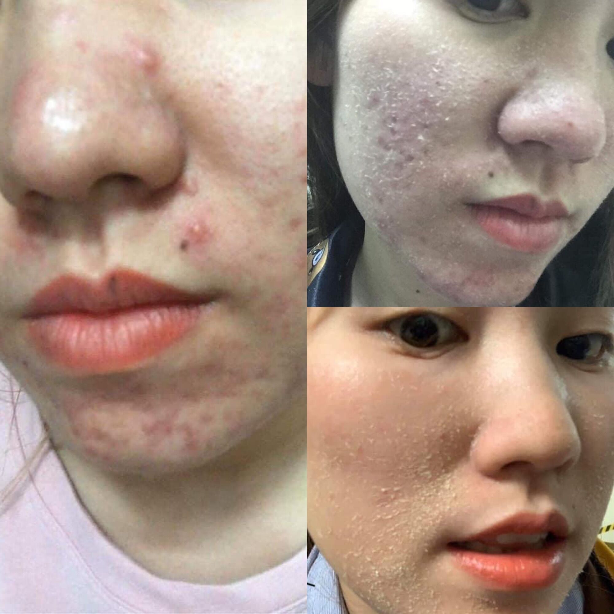 Combo ( tái tạo da - bột rửa mặt) yody giúp tái tạo da