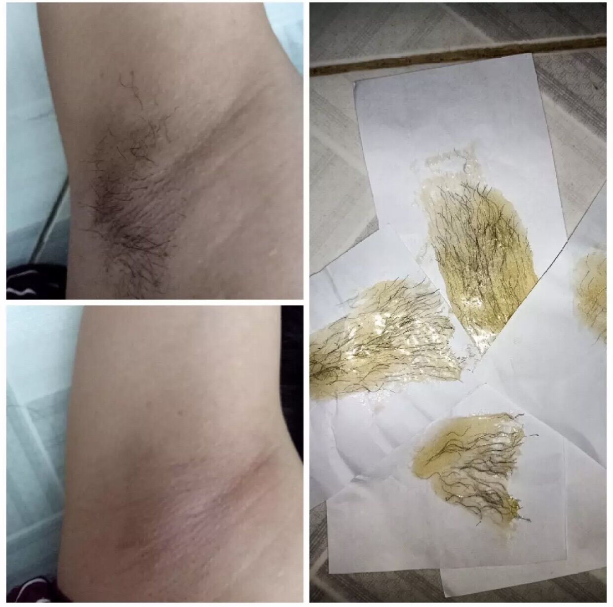 [CHÍNH HÃNG] Wax Lông + Mỡ Trăn Triệt Lông Shiny ( Tặng bộ Giấy, Que Wax )