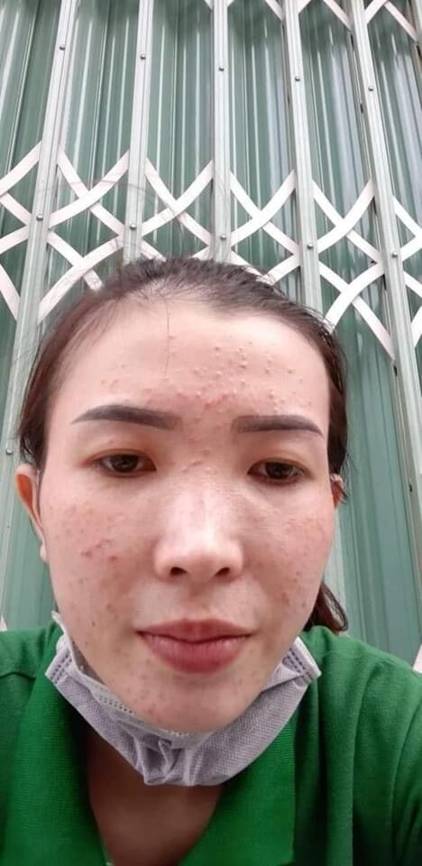 Kem Thải Độc Da Jewel Hàn Quốc 20g