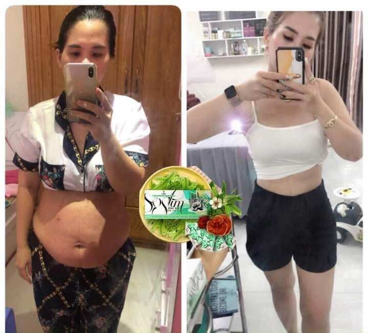 KẸO GIẢM CÂN SOSLIM