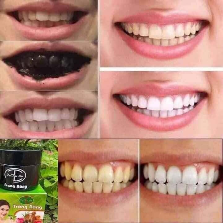 Bột trắng răng than tre Dạ Thảo Liên