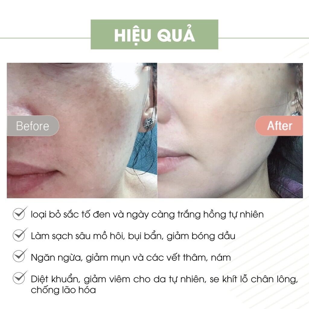[Chính Hãng] Serum Spot Essance Acosmetics Huyết Thanh A