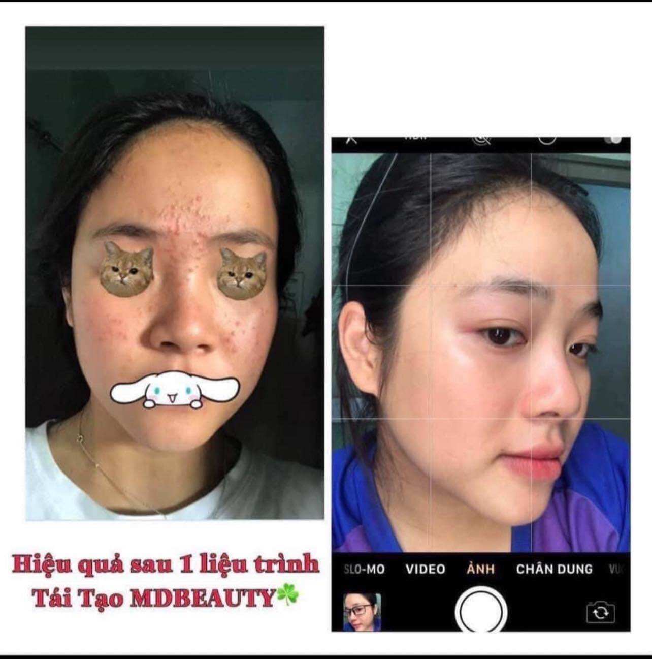 Thuốc bắc tái tạo da ( chính hãng)lẻ = sỉ