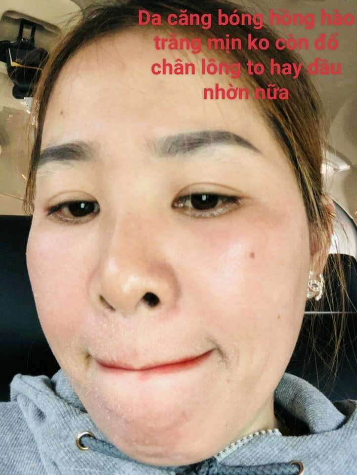 COMBO TÁI TẠO HỒNG SÂM ( CHÍNH HÃNG 100% GIẢM GIÁ 30%)