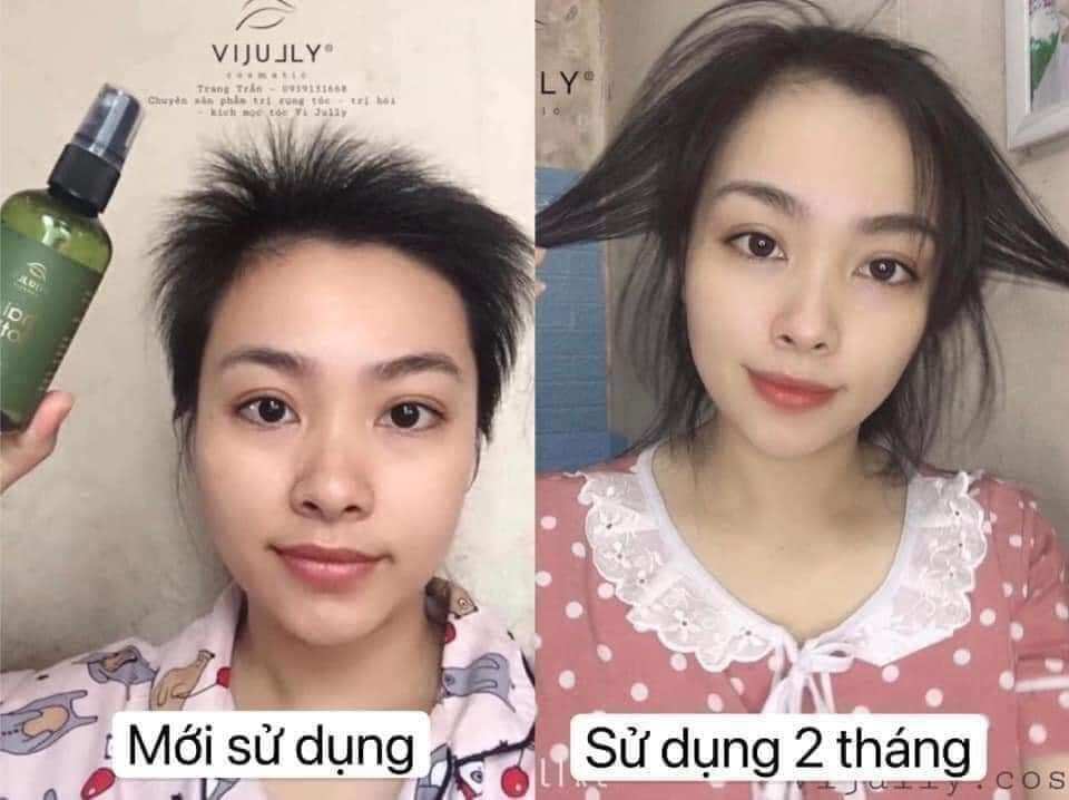 Lotion bưởi - kích mọc tóc, ngăn ngừa rụng tóc