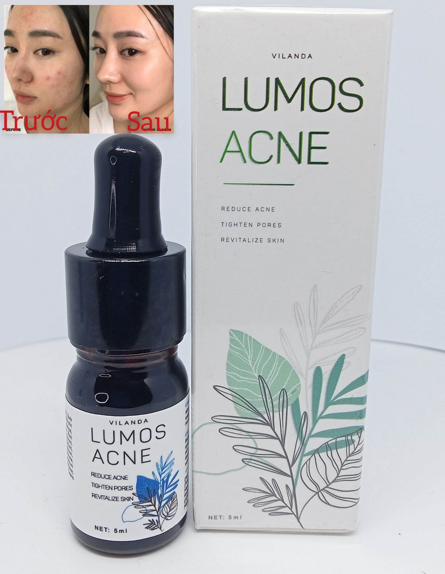 Serum Mụn Lumos Acne Chính Hãng 💯 Hàn Quốc