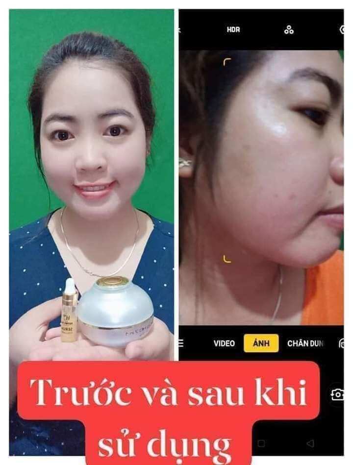 [TẶNG KÈM SERUM VÀNG 24K+ MẶT NẠ] Kem face vip 7 in 1 Huỳnh Đỗ