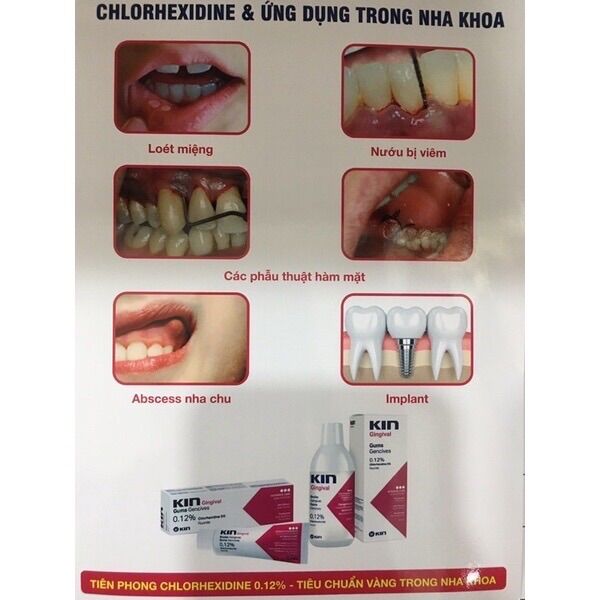 NƯỚC SÚC MIỆNG DIỆT KHUẨN KIN GINGIVAL 250ml