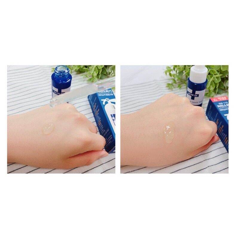 Chấm mụn Isoi Anci Doctor 14ml