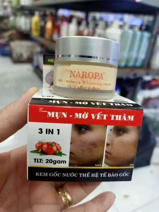 Kem NAROPA Mụn - Mờ Vết Thâm 20g Nay Đổi Mẫu Tên Mới Kem Mạn Ngọc