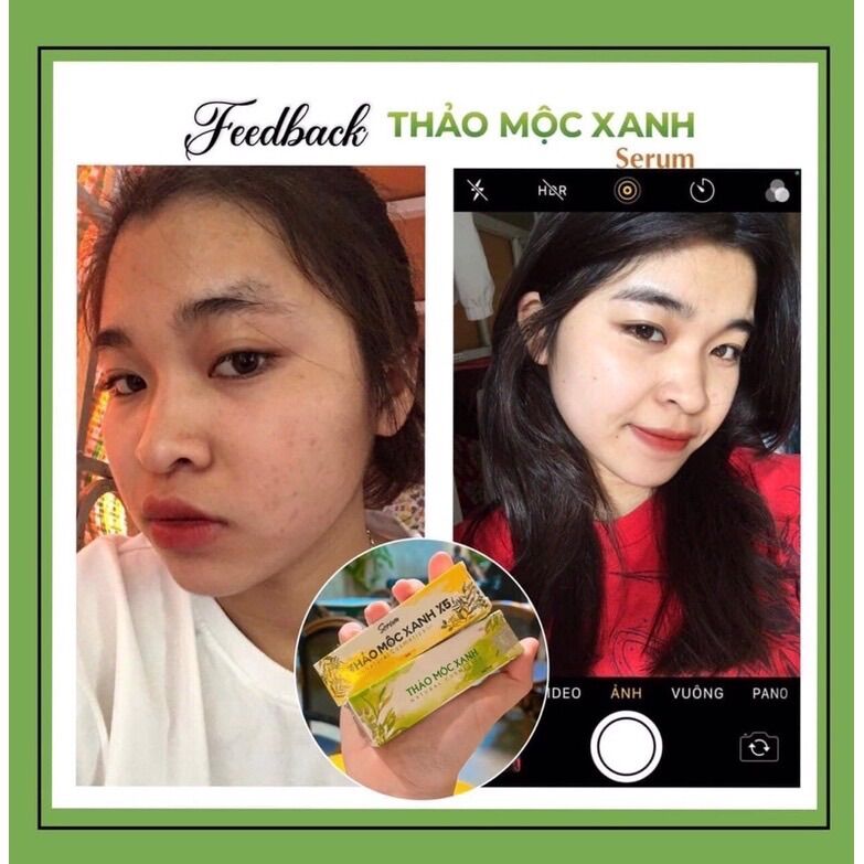 Serum Thảo Mộc Xanh 3 lọ