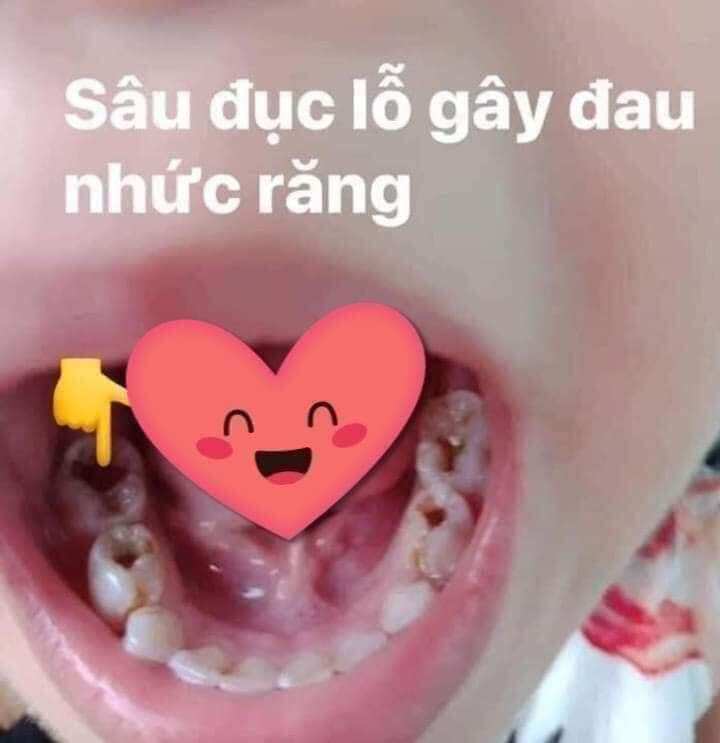 Combo 2 lọ khoi hoàn toàn sâu răng