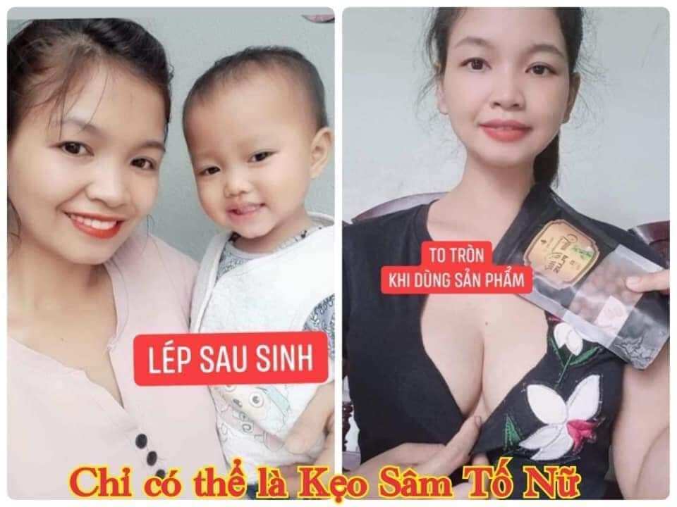 Kẹo mầm sâm tố nữ plus x2 thảo mộc 37(mua 4 hộp tặng 1 hộp nữa là 5 tặng kèm dây đo )