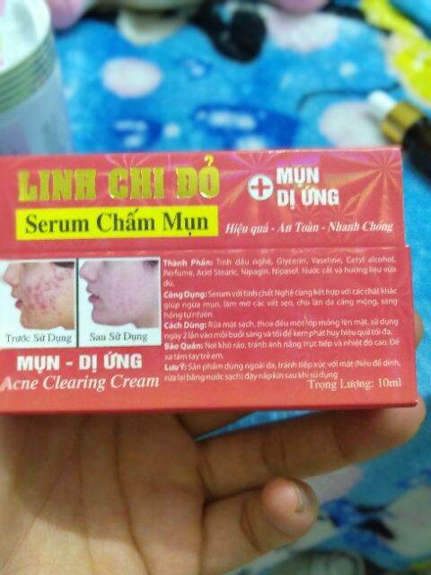 sirum  mụn linh chi đỏ chai 20 ml