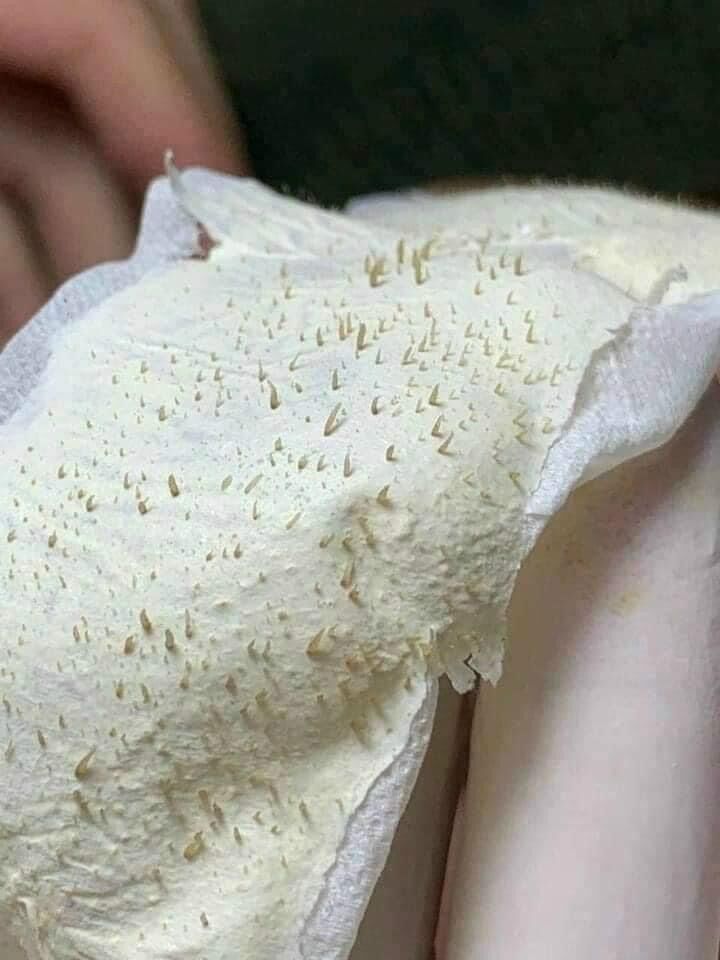Gel lột mụn nha đam thái lan