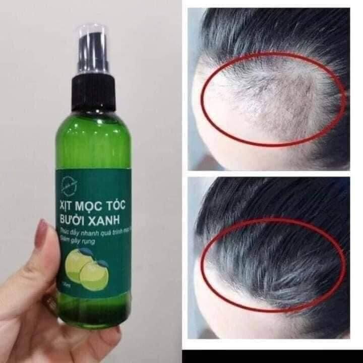 XỊT KÍCH MỌC TÓC BƯỞI XANH