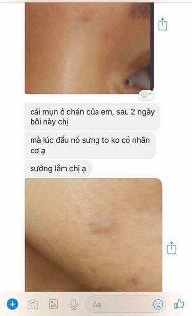 Chấm Mụn Clinda-M Thái Lan