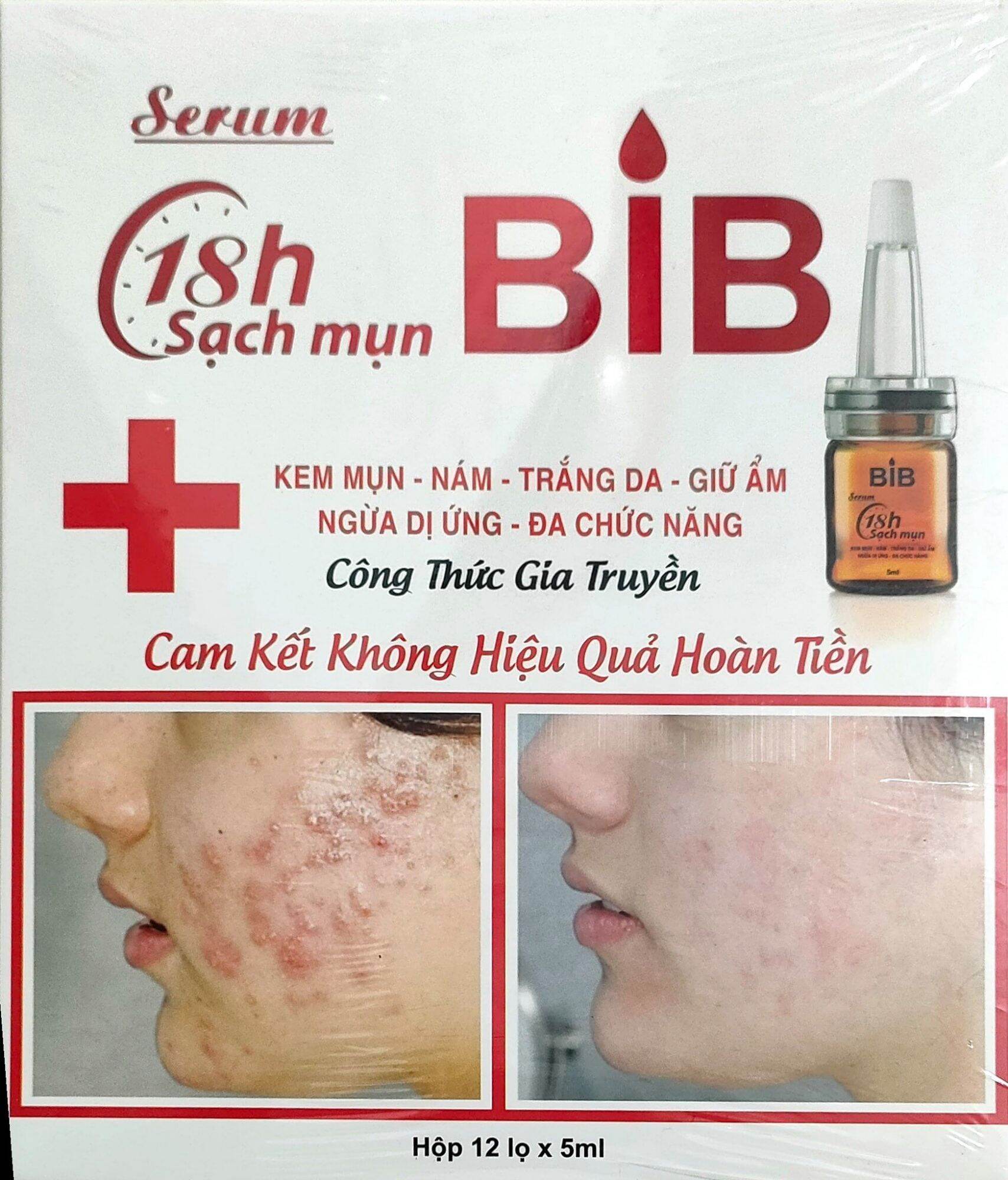 Sirum Mụn Chuyên Sâu (Tinh Chất Tế Bào Gốc)