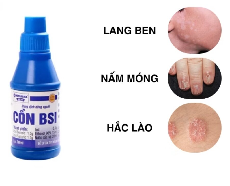 Cồn BS.I HD Pharma dung dịch sát trùng 20ml dùng cho lang ben, nấm mốc, hắc lão