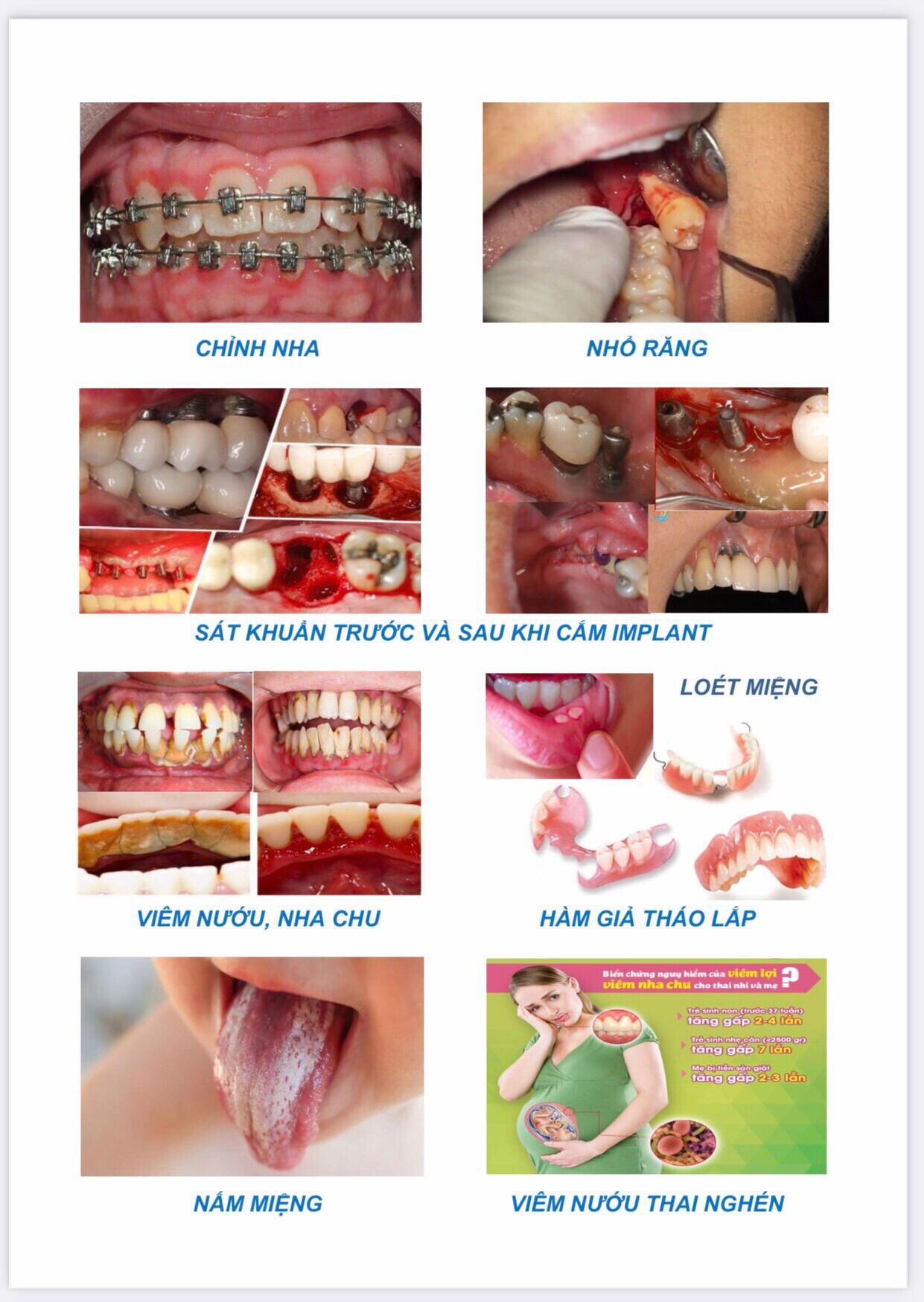 Nước xúc miệng Kinni