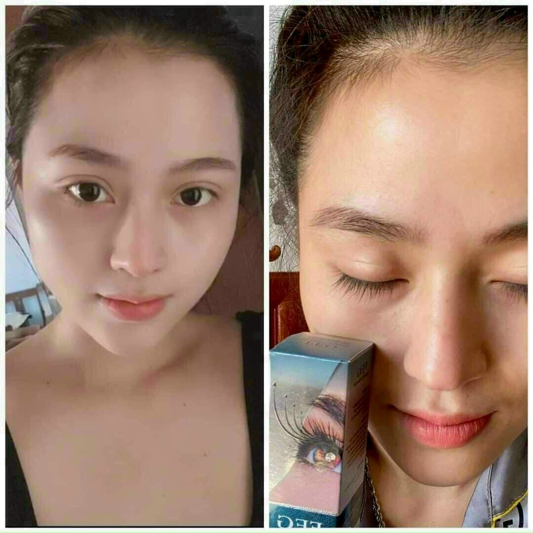 serum dưỡng mi kích dài mi  combo 2 cây 1 cặp
