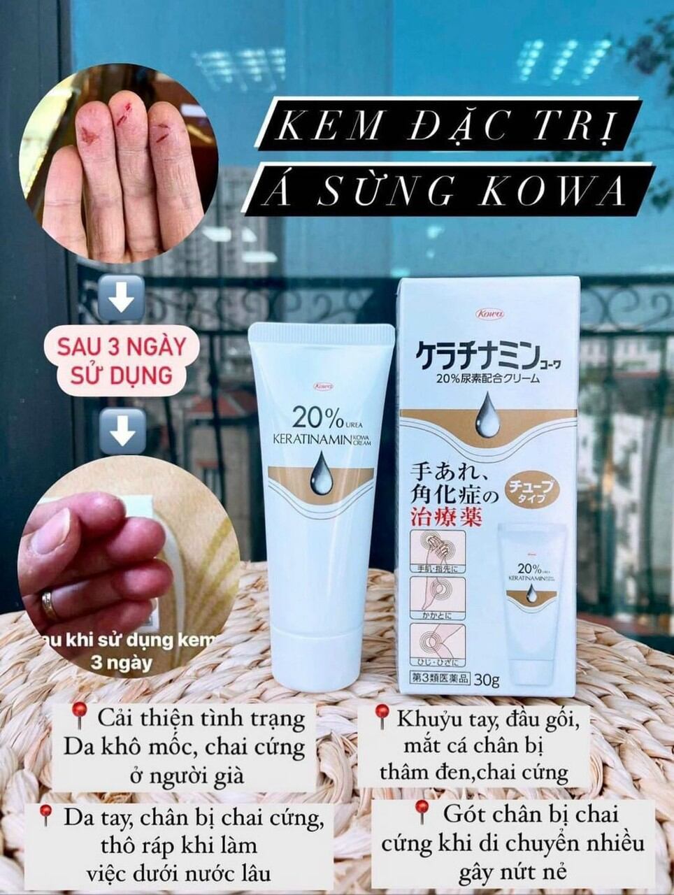 kem bôi nứt nẻ tay chân  á sừng