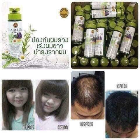 Dầu gội kích thích mọc tóc Hairloss thái lan