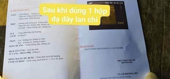DẠ DÀY ĐAN 👉 trào ngược dạ dày 👉ợ nóng.ợ chua.đau dạ dày