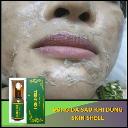 COMBO 5 VI TẢO BONG DA