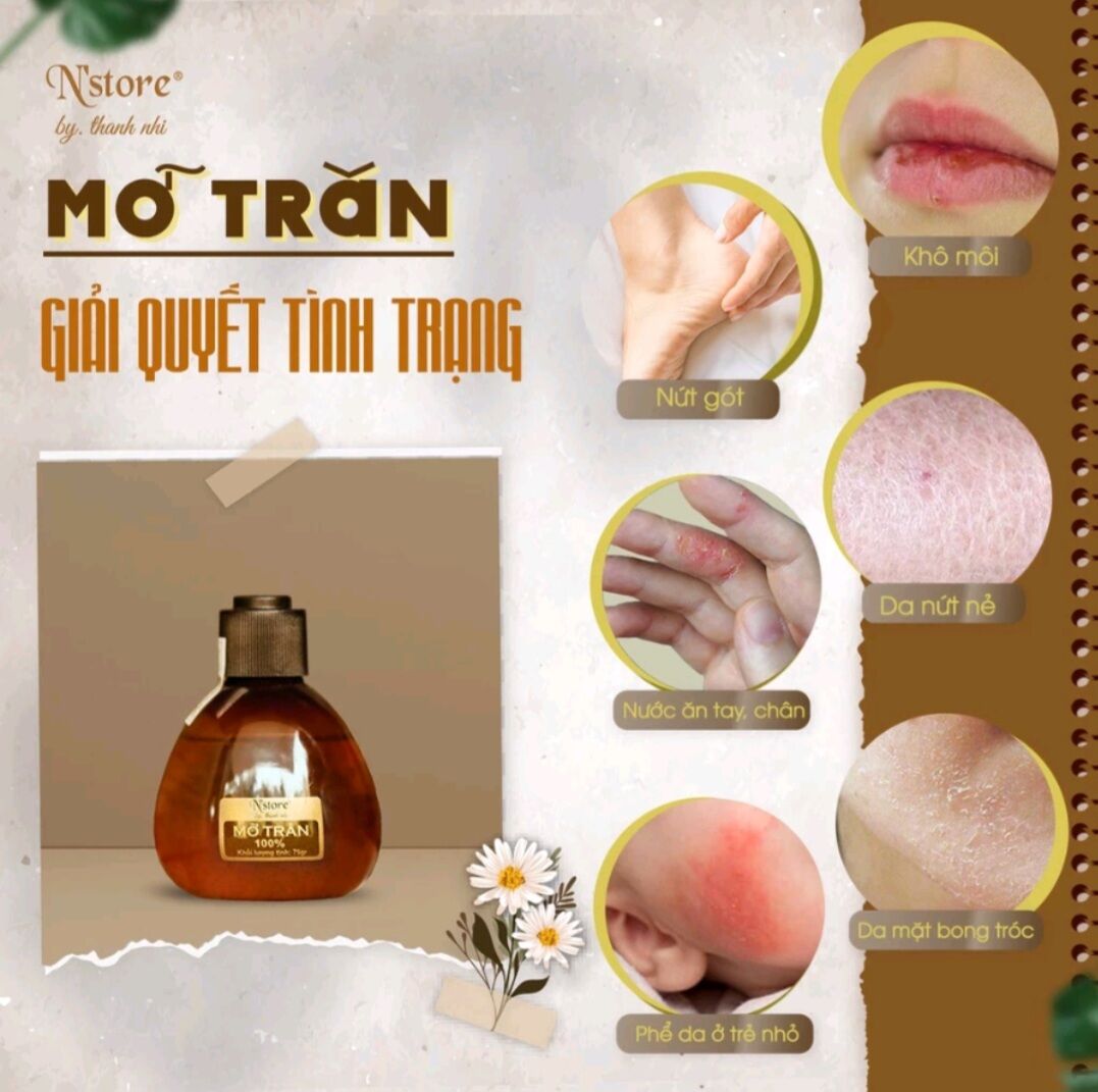Mỡ trăn nguyên chất N'store, triệt lông, mờ rạn da