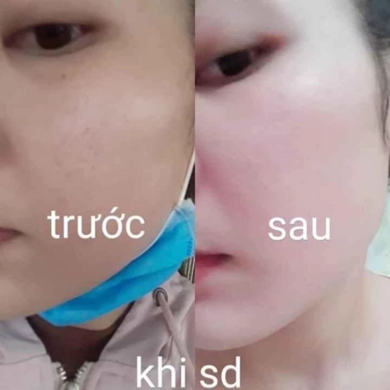 [HÀNG CHUẨN XỊN] Combo 3 sản phẩm  Kem Collagen Plus Vit E + Serum Vite [hàng chuẩn]
