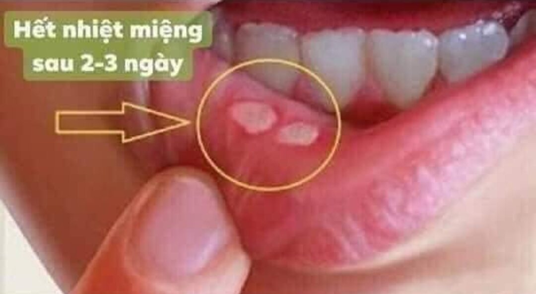 Tinh dầu răng miệng Dạ Thảo Liên 5ml