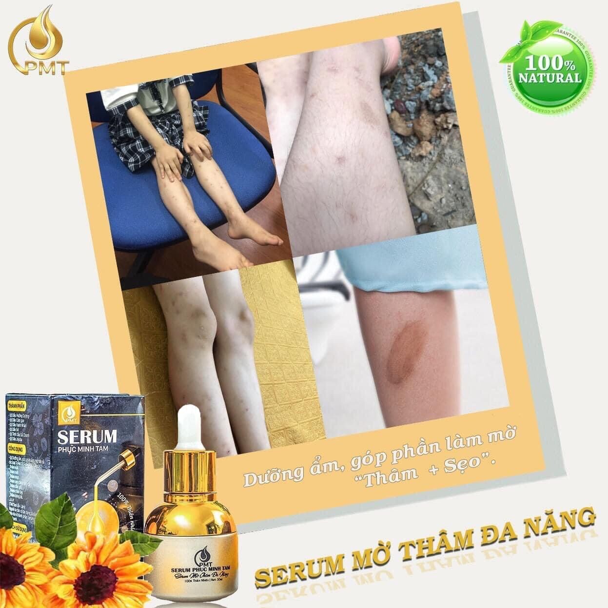 Serum thâm phúc minh tâm
