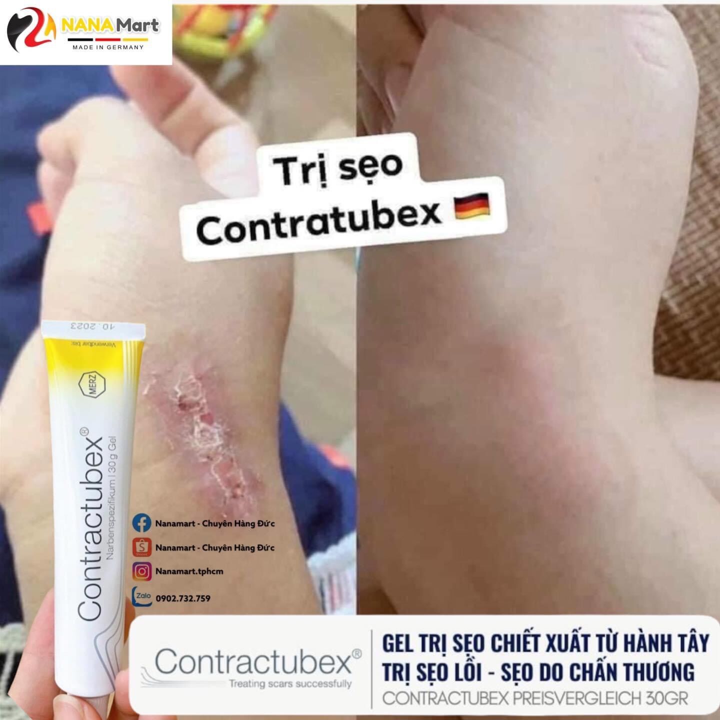 Kem Kem làm mờ sẹo Contractubex Đức, tuýp 30g