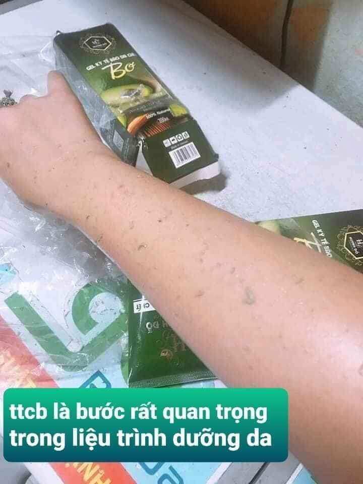 gel tẩy tế bào da chết bơ huỳnh đỗ