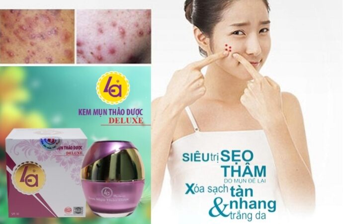 kem Mụn Thảo Dược Deluxe LA 20g