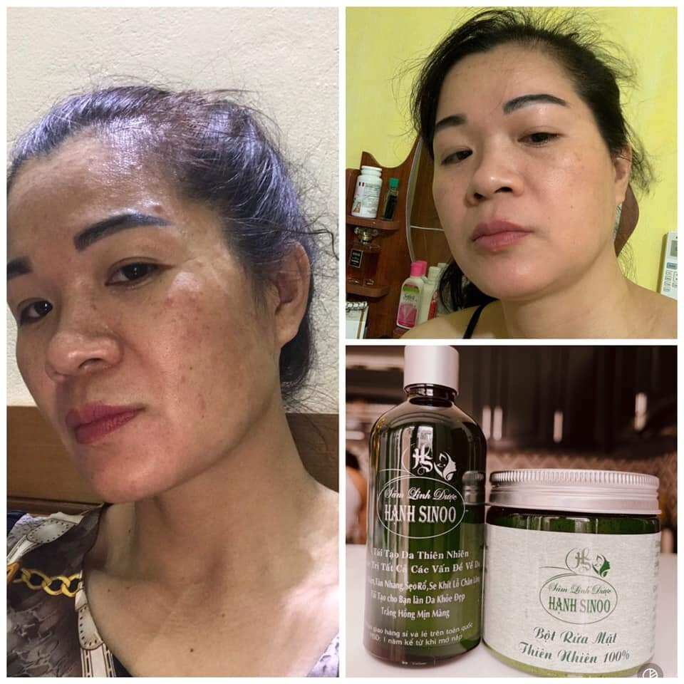 COMBOL SÂM LINH DƯỢC HẠNH SINOO(BỘT SÂM)